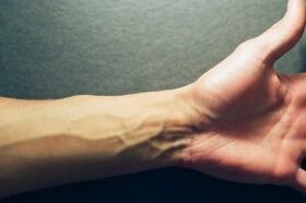 hand