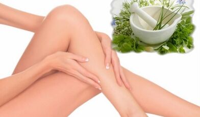 Treatment of lower leg varicose veins with folk medicine