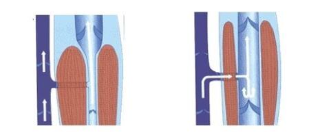 properly functioning venous pump
