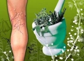 Traditional medicine in the fight against varicose veins on the lower legs