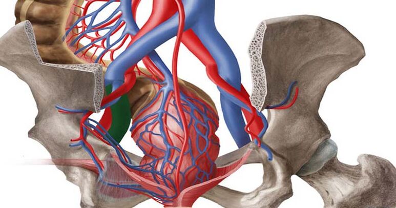 Pelvic varicose veins